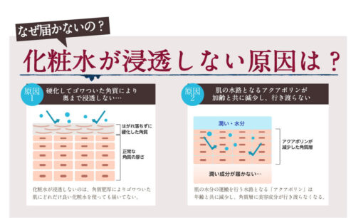 画像配置 500 × 306